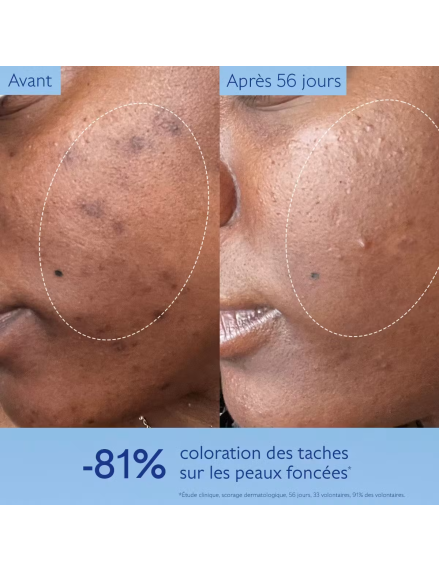 Caudalie Vinoperfect Sérum Éclat Anti-Taches à la Viniférine